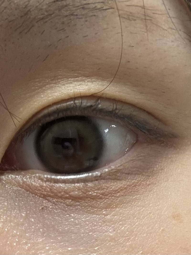 [잡담] 이거 아이홀이야 아니면 눈두덩이 피부가 쳐진거야? | 인스티즈