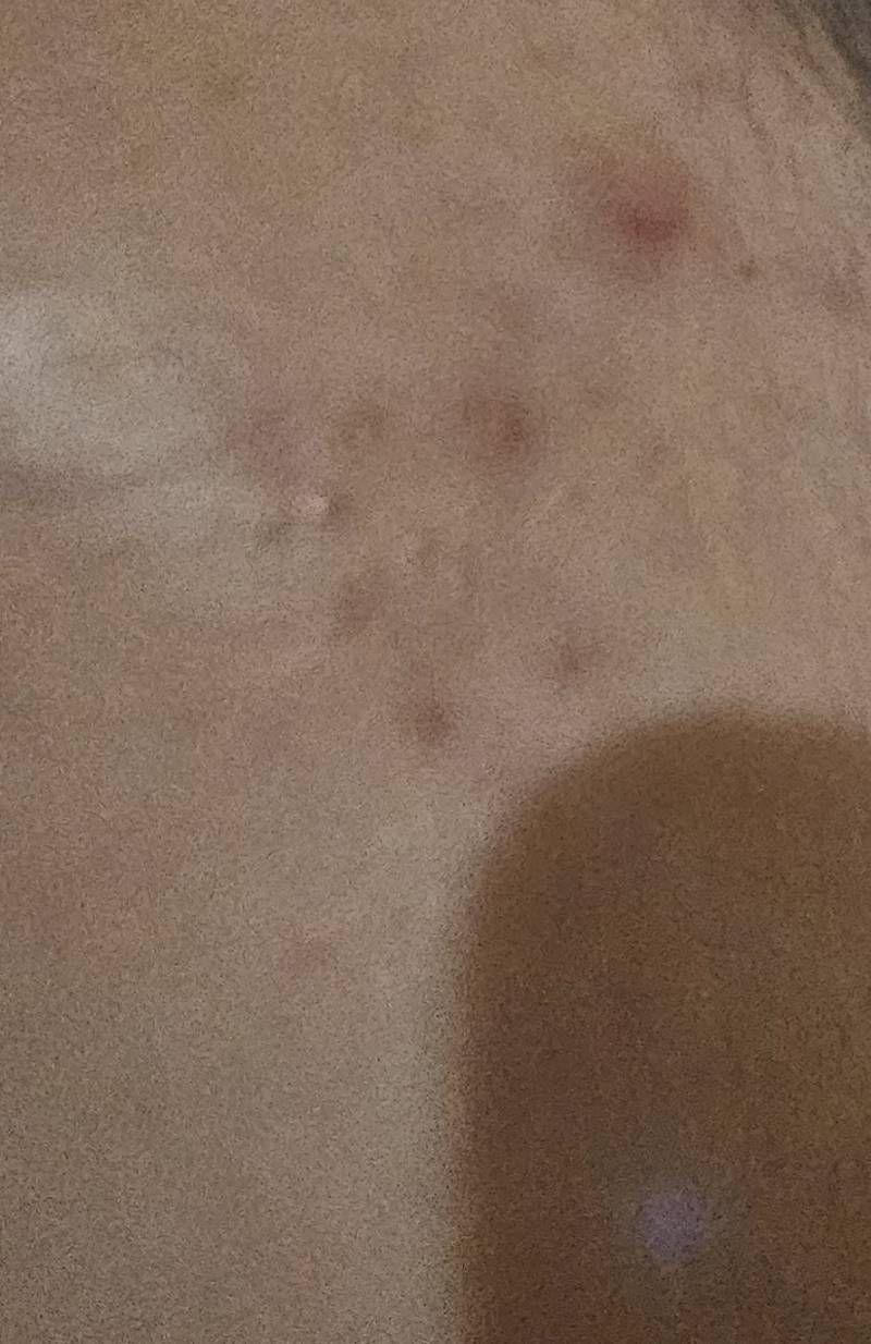 [잡담] 나 피부 왜 이러지 ㅠㅠ | 인스티즈