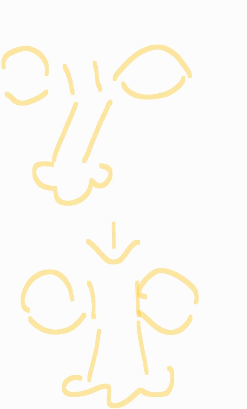 휜 콧대가 다시 1자가 될수있나..? | 인스티즈