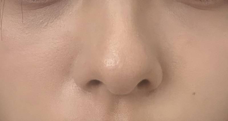 [잡담] 팔자랑 눈밑 많이 처졌어? 이런거뭐해야해? | 인스티즈