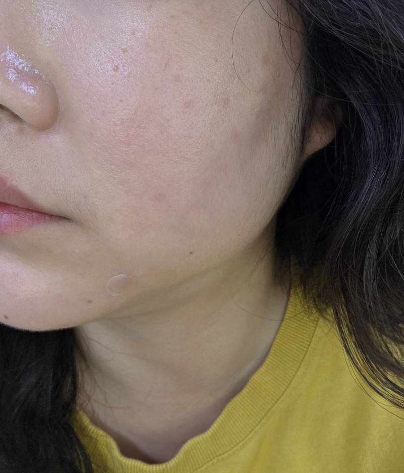 [잡담] 피부 복구한 기념으로 자랑하러 왔심 | 인스티즈