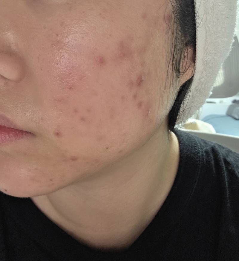 [잡담] 피부 복구한 기념으로 자랑하러 왔심 | 인스티즈