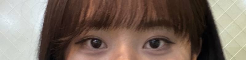 [잡담] 쌍커풀 있는데 쌍수 할말? | 인스티즈