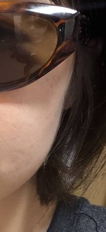 [잡담] 나 이거 땅콩형이야? 사각턱이야? | 인스티즈