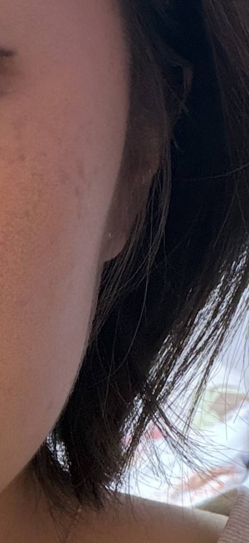 [잡담] 나 이거 땅콩형이야? 사각턱이야? | 인스티즈