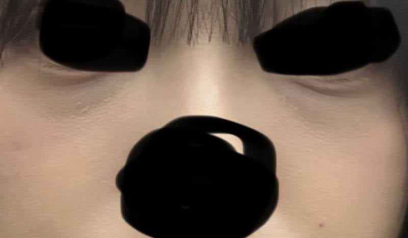 [잡담] 눈밑지야 아님 다크서클이야? | 인스티즈