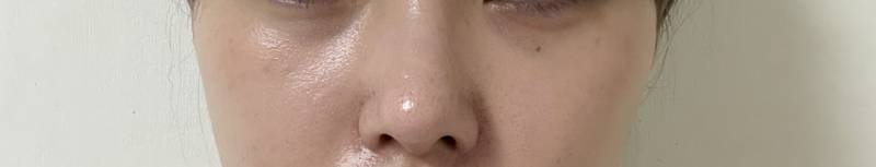 [잡담] 나 이거 성형외과 개진상임? | 인스티즈