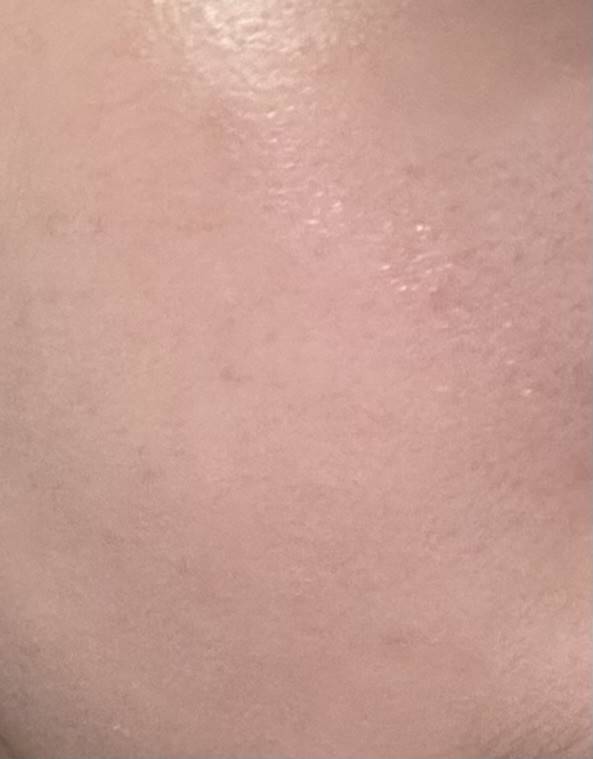 [잡담] 그래도 피부 마니 좋아졌다...ㅠ | 인스티즈