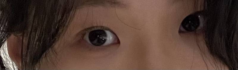[잡담] 나 앞트임 할말.. | 인스티즈
