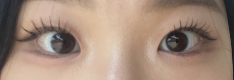 [잡담] 나 앞트임 할말.. | 인스티즈