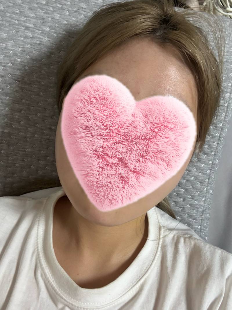 [잡담] 얘들아 나 얼굴 문제있는사람같아? | 인스티즈