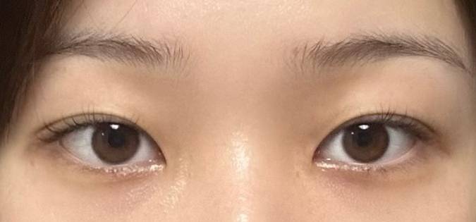 [잡담] 이런 눈은 무슨 라인이야?? | 인스티즈
