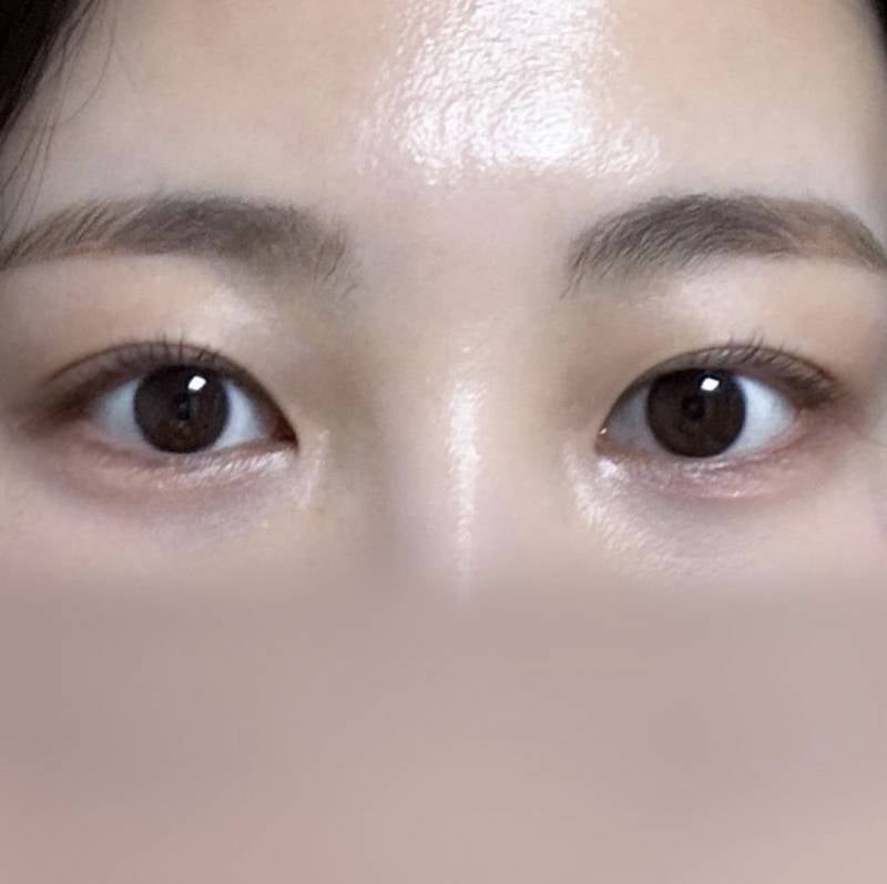 [잡담] 이런 눈은 무슨 라인이야?? | 인스티즈