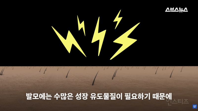 30년동안 여성의 탈모를 연구한 탈모 시장 '대모님' | 인스티즈