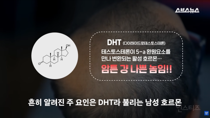 30년동안 여성의 탈모를 연구한 탈모 시장 '대모님' | 인스티즈