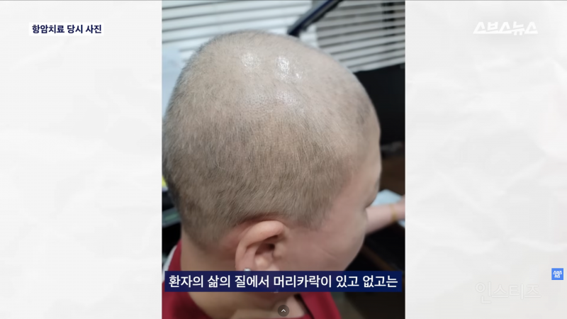30년동안 여성의 탈모를 연구한 탈모 시장 '대모님' | 인스티즈