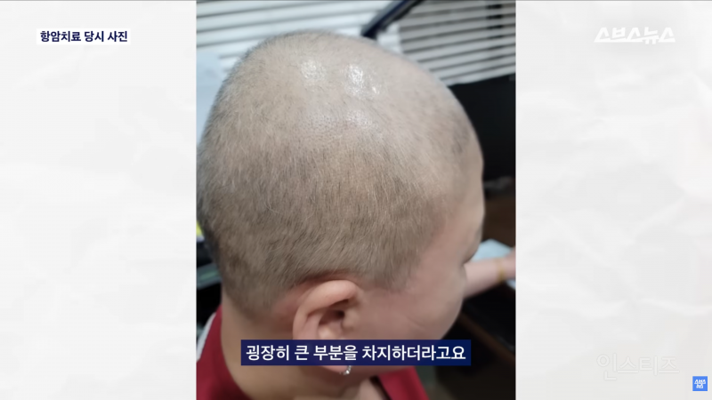 30년동안 여성의 탈모를 연구한 탈모 시장 '대모님' | 인스티즈