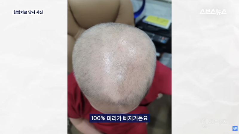 30년동안 여성의 탈모를 연구한 탈모 시장 '대모님' | 인스티즈