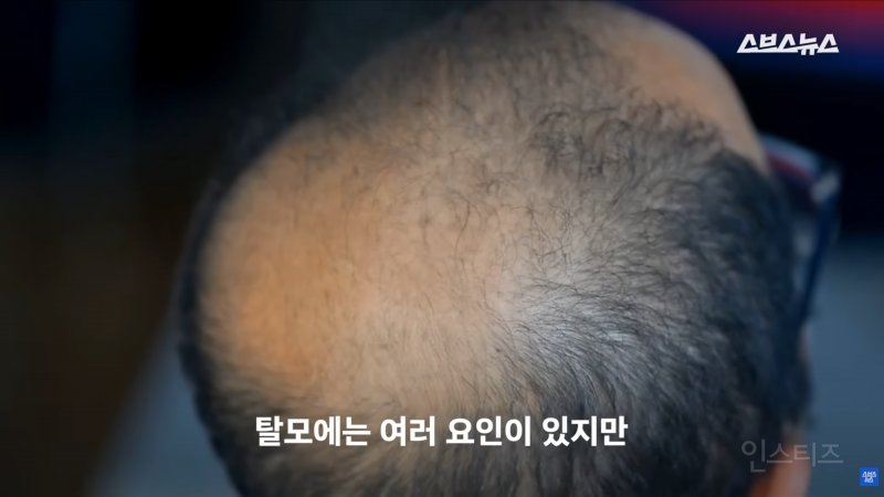 30년동안 여성의 탈모를 연구한 탈모 시장 '대모님' | 인스티즈