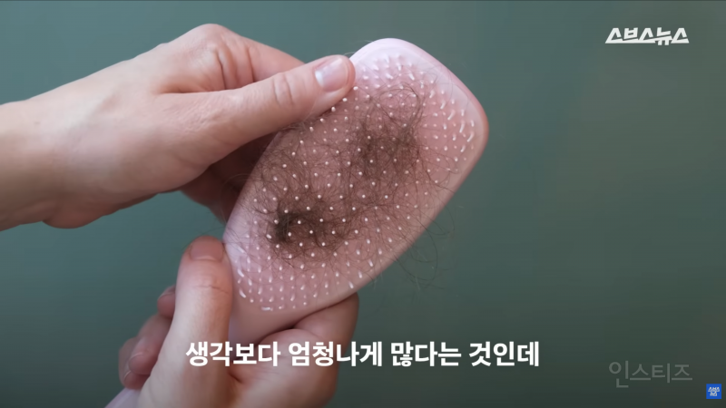 30년동안 여성의 탈모를 연구한 탈모 시장 '대모님' | 인스티즈