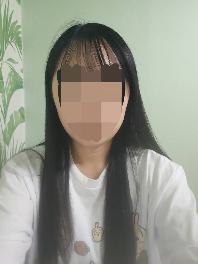 [잡담] 땅콩형 얼굴인데 무슨 시술 받는게 좋을까? | 인스티즈
