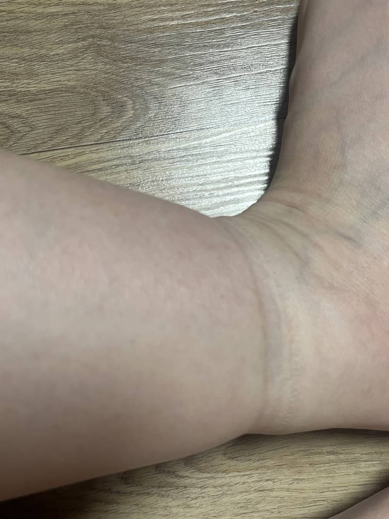 [잡담] 이거 하체부종 심각한거야?? 병원갈 수준인지 봐주라 ㅠ | 인스티즈