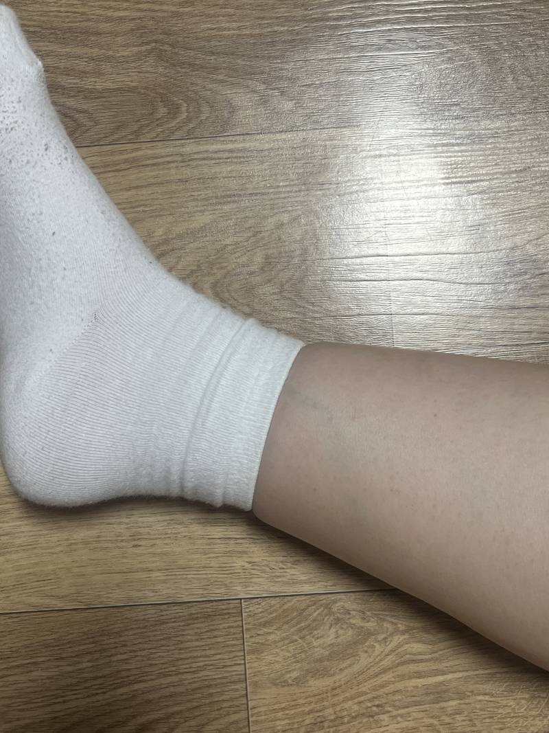 [잡담] 이거 하체부종 심각한거야?? 병원갈 수준인지 봐주라 ㅠ | 인스티즈