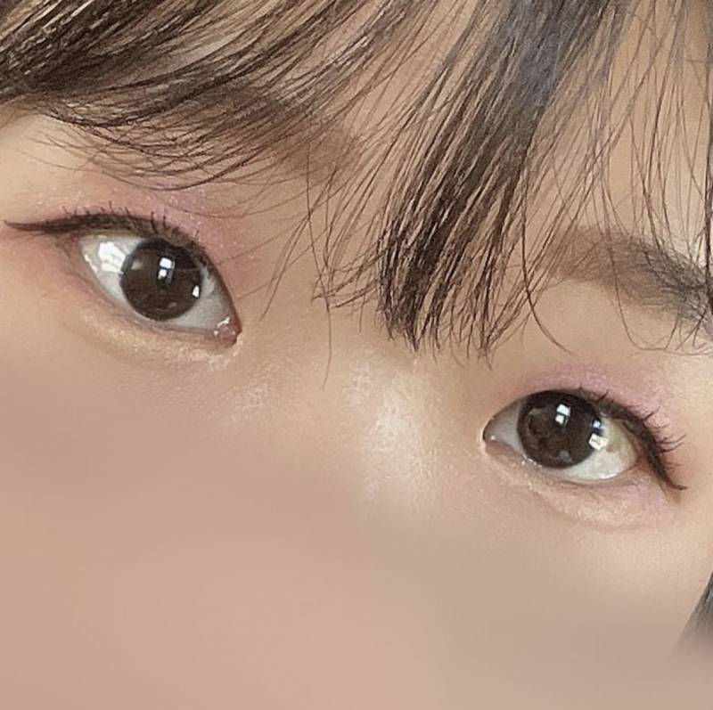 [잡담] 이거 앞트임 망한 거 아니야? | 인스티즈