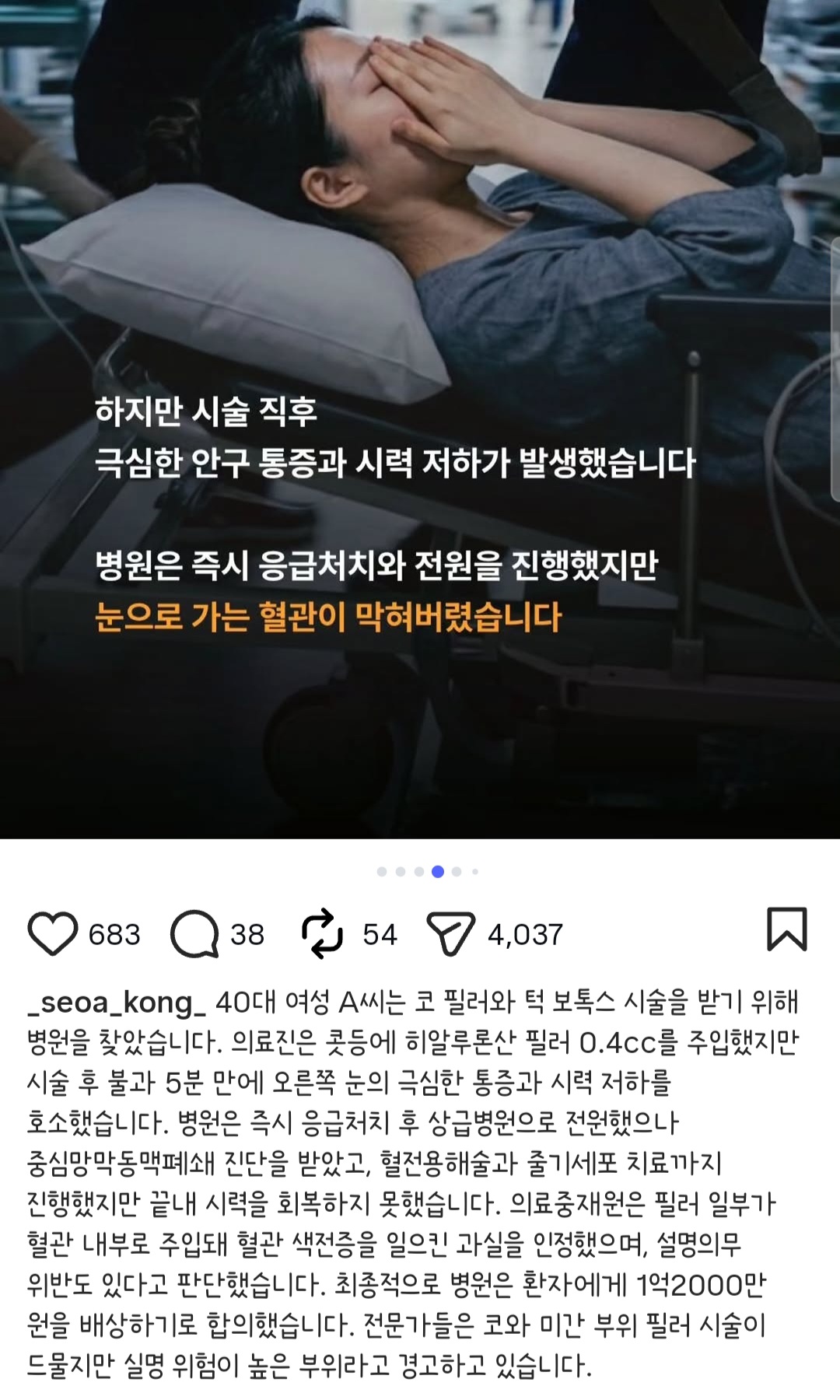 [잡담] 코 필러 맞고 실명됐대 | 인스티즈