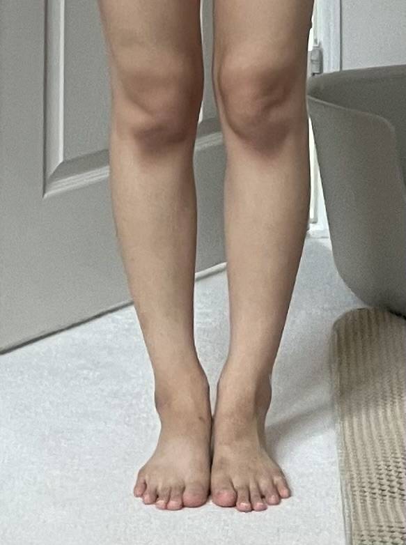[잡담] 나 종아리 어떤지 판단 해주라… 많이 두꺼워? | 인스티즈