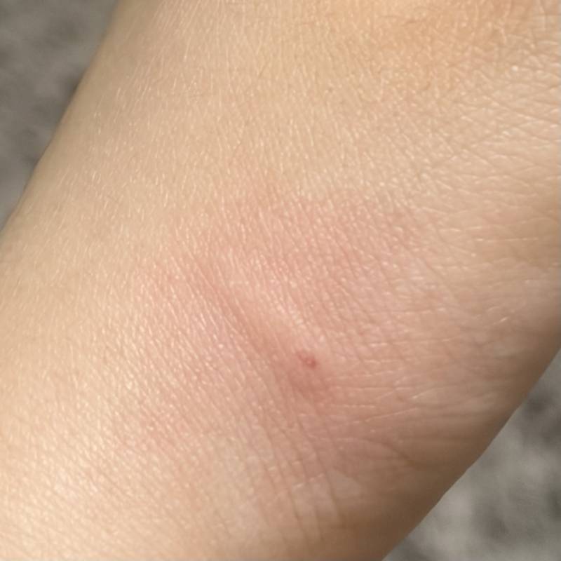 [잡담] 얘들아 나 강아지한테 처음 물려보는데 이 정도는 괜찮을까.. 제발 봐주ㅏㅜ | 인스티즈