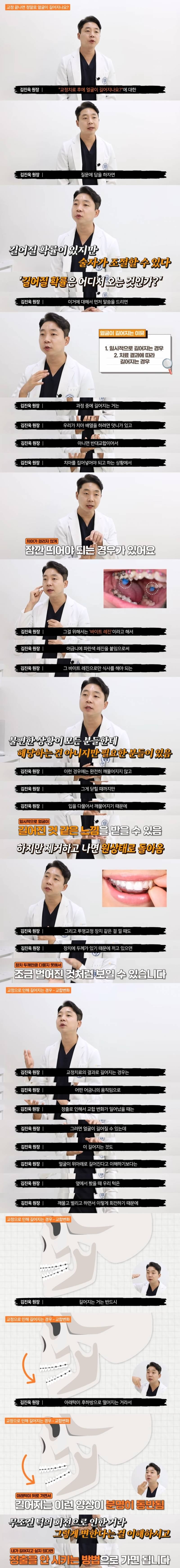 소소하게 화제중인 치아교정하고 얼굴 길어지는 이유.jpg | 인스티즈