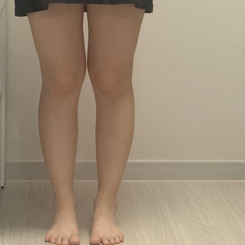 [잡담] 나 다리 x자 넘 심하지 | 인스티즈