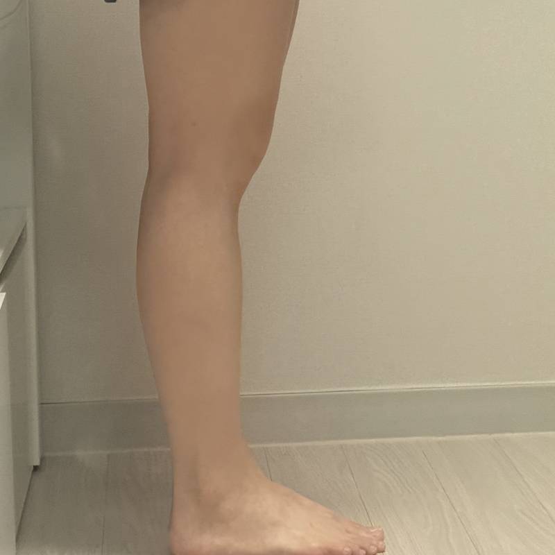 [잡담] 나 다리 x자 넘 심하지 | 인스티즈