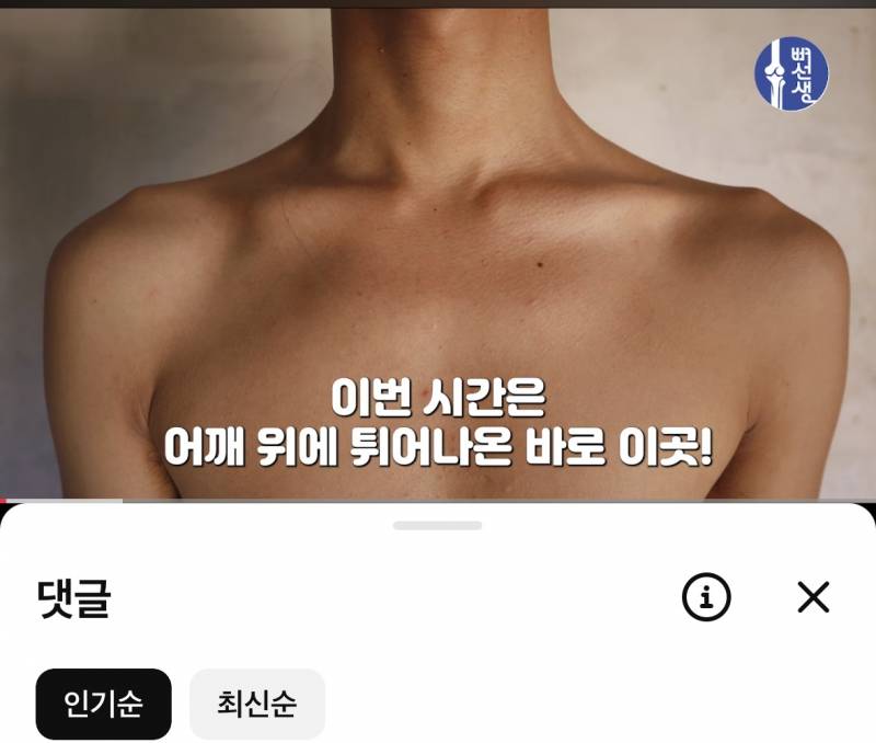 [잡담] 어깨 뼈 이렇게 튀어나온 사람 있어? | 인스티즈