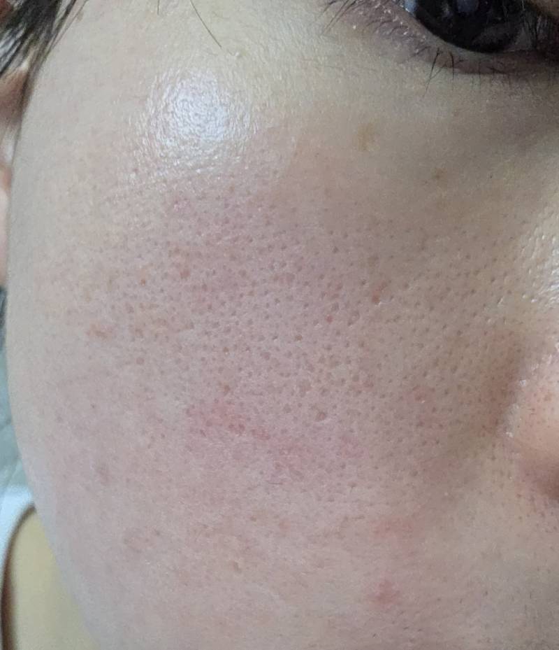 [잡담] 애인 피부가 이정도면 어떨 것 같아..ㅎㅇㅈㅇ | 인스티즈