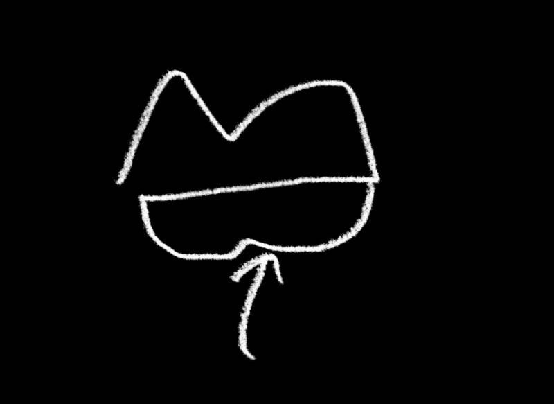 [잡담] 입술필러 이틀찬데 궁금한 게 잇어 ㅈㅔ발 도움 | 인스티즈
