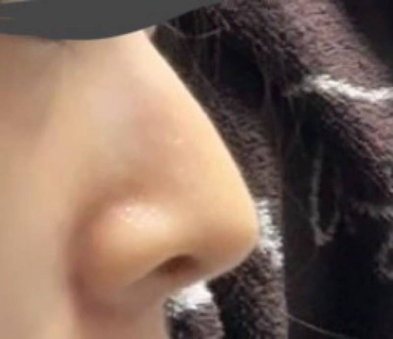 [잡담] 코 할까 | 인스티즈