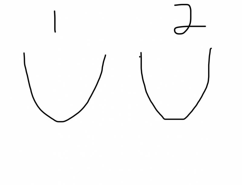 [잡담] 턱라인이 이러면 무슨 시술 받아야해? | 인스티즈