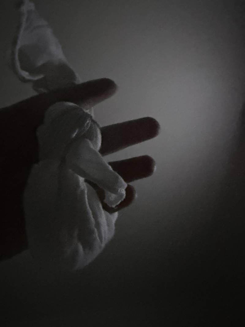 [잡담] 일하다 손 다쳐서 부었는데 엄마가 얼음반지 해줌 | 인스티즈