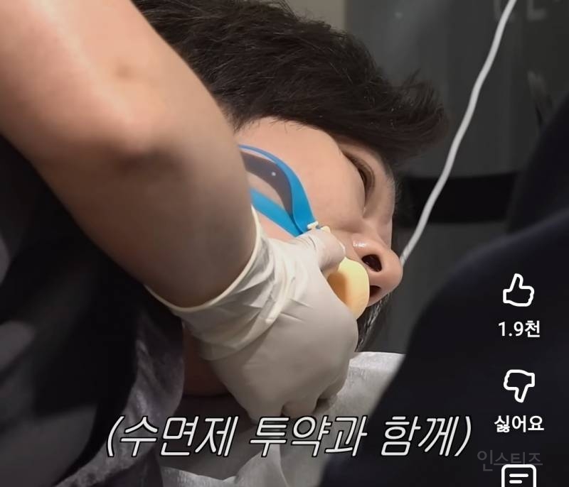 수면내시경 하는데 눈뜨고 자는 이창섭.jpg | 인스티즈