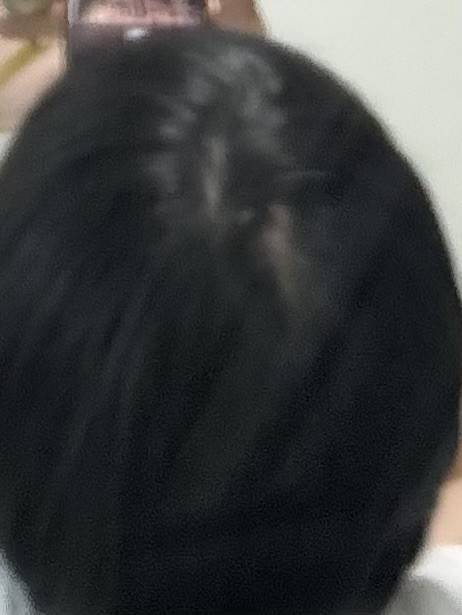 [잡담] 뒷통수에 이런게 생겼는데 뭐지…? | 인스티즈