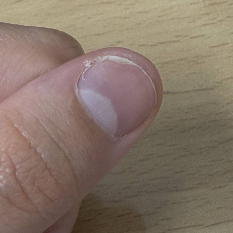 [잡담] 손톱 바디 어떻게 해야 늘어나 ? | 인스티즈
