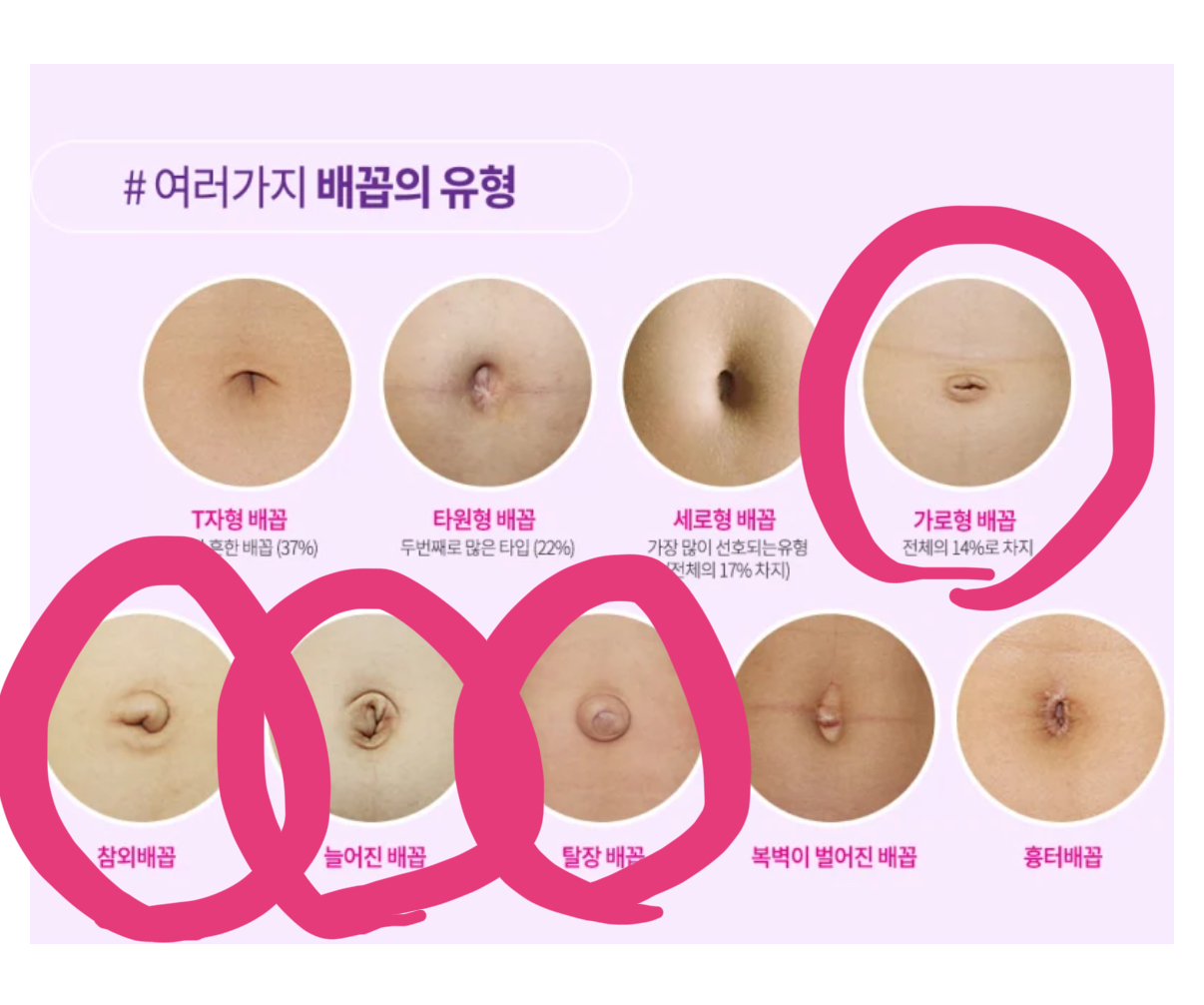 [잡담] 진짜로 이런 배꼽이 잇어……….? 내가 동그라미친 배꼽들 | 인스티즈