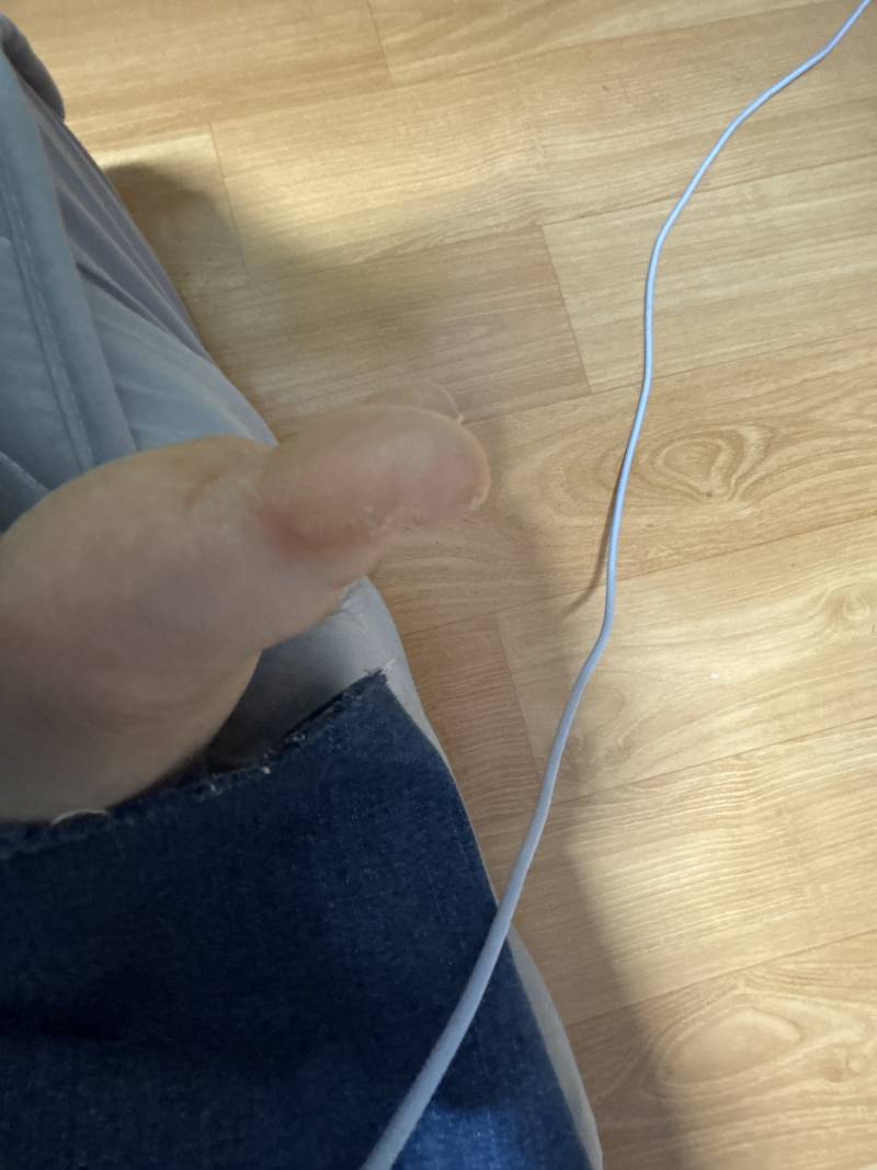 [잡담] 이거 없애는 방법좀 | 인스티즈