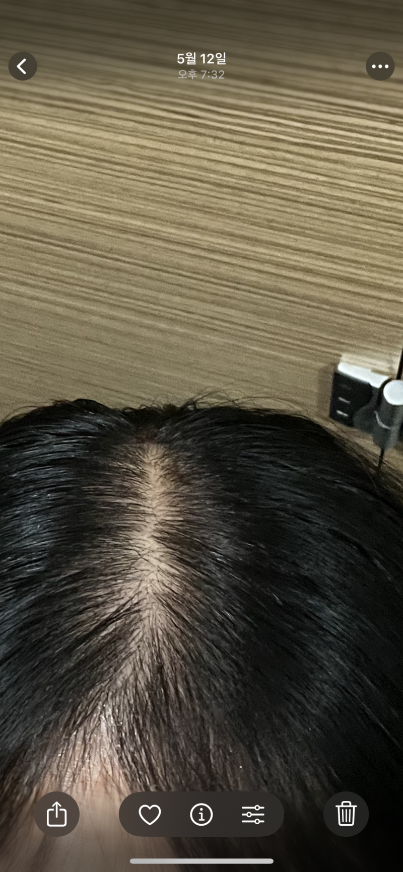 [잡담] 여성탈모맞지?? | 인스티즈