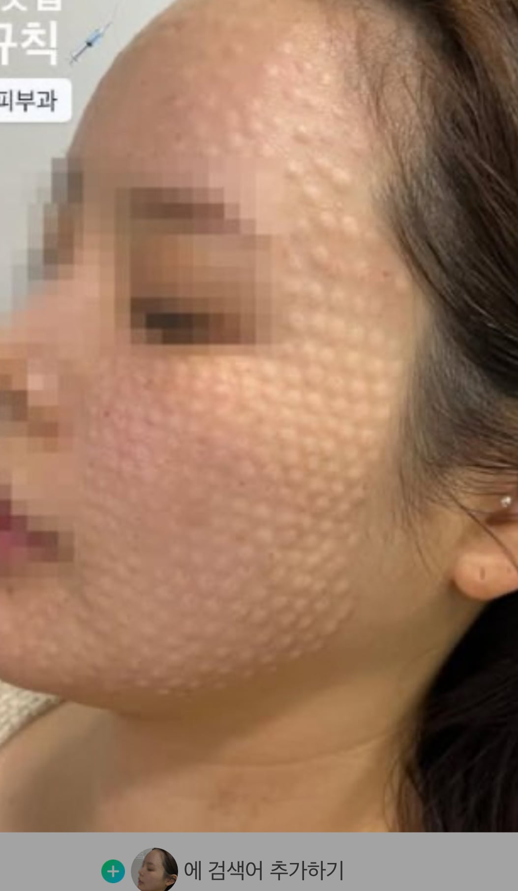 [잡담] 2번째사진이 더 리쥬란 잘하는거야? | 인스티즈