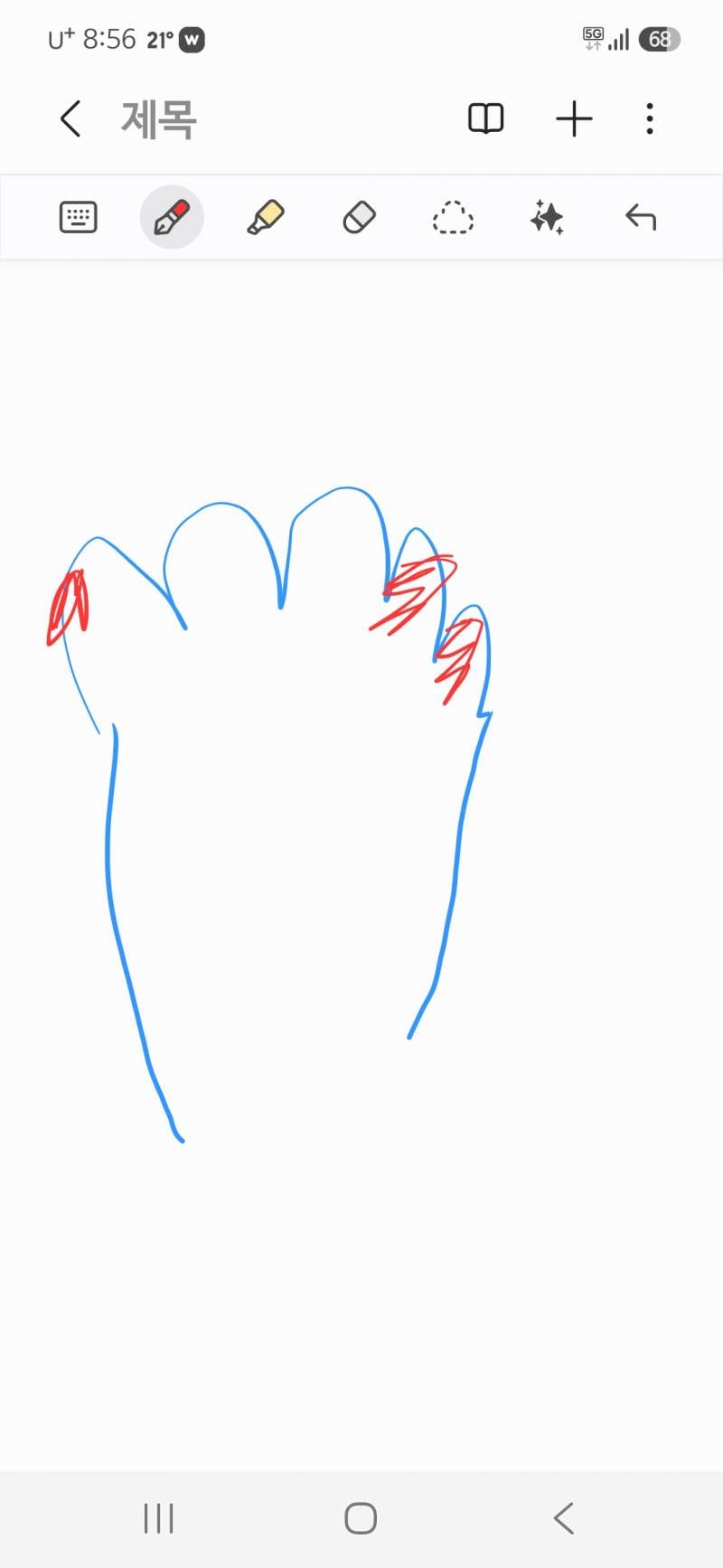 [잡담] 런닝하고나면 항상 오른쪽 발가락에 물집생기고 붓는데 신발이 작은걸까? | 인스티즈