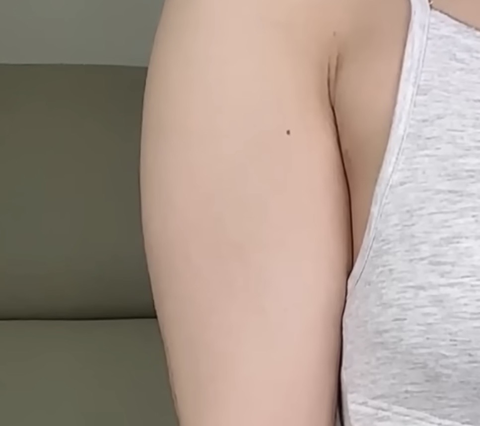 [잡담] 이렇게 불룩하게 튀어나온 팔뚝살 없애려면 | 인스티즈