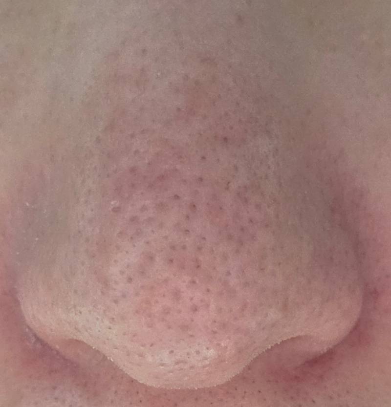 [잡담] (혐오주의)코모공 어카지... | 인스티즈